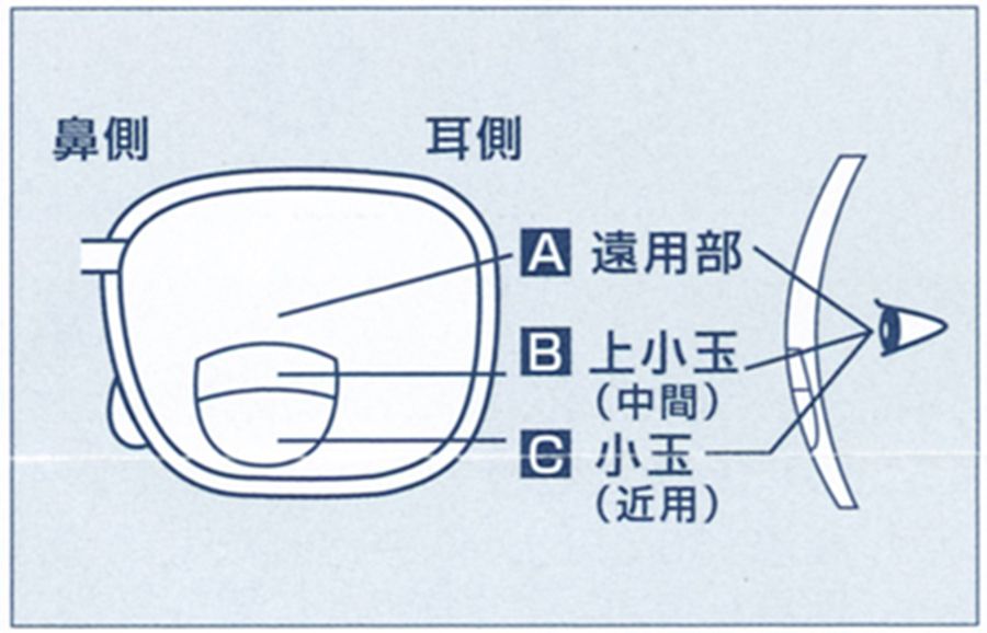 トライフォーカル(三重焦点)レンズ